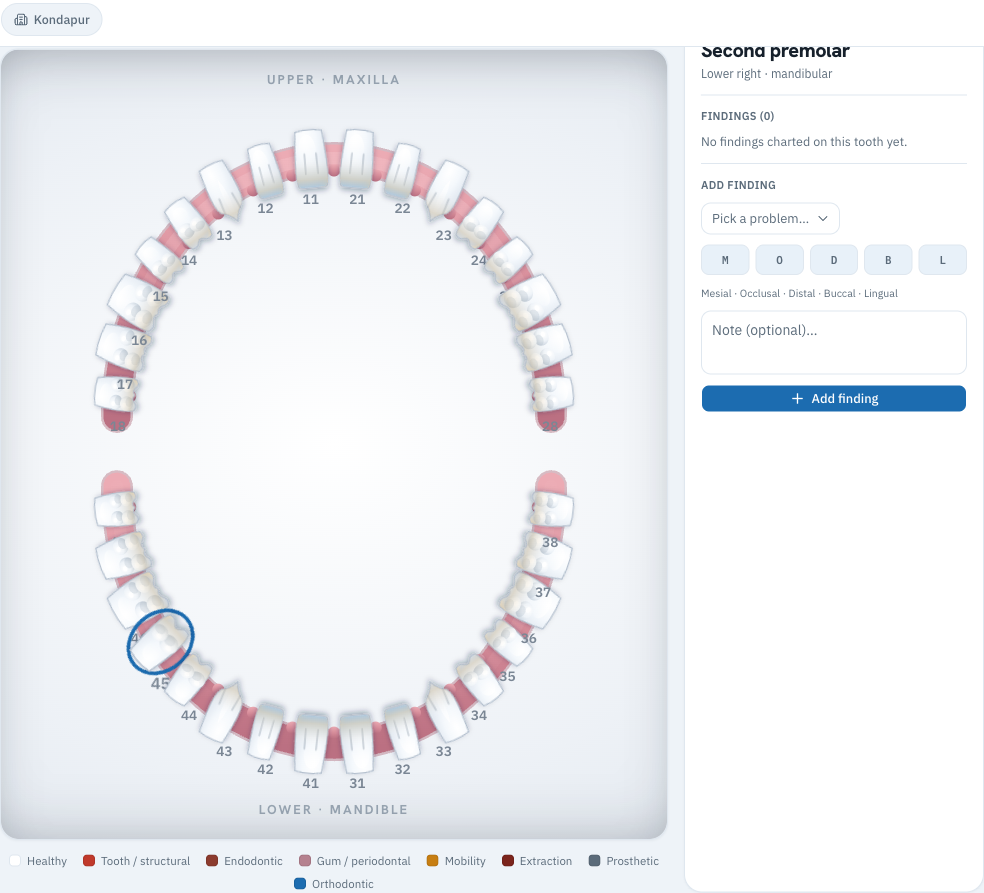 Interactive FDI tooth chart with a per-tooth findings panel and a colour-coded category legend